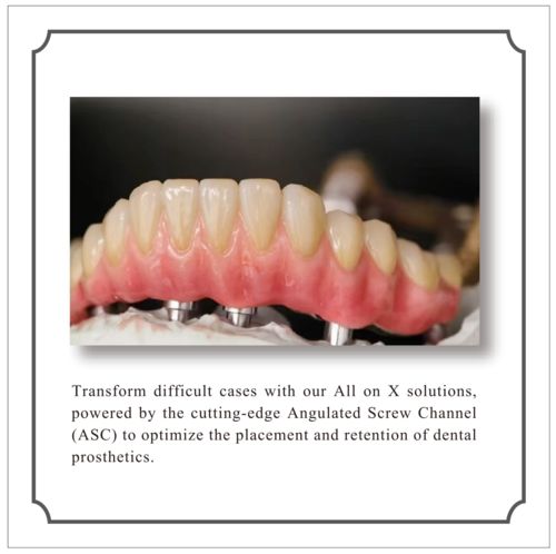 All-on-X Restoration using Full Digital Workflow and New Generation Horizontal Scan Gauges