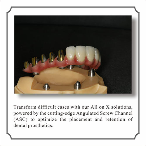 All-on-X Restoration with Full Digital Workflow and Next-Generation Horizontal Scan Gauges
