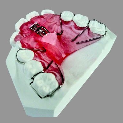 comprar Placa de expansión extraíble Ortodoncia Movimiento anterior personalizable online manufacture