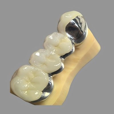 Buy Casting / Digital CoCr Dental PFM Bridge with Polished Surface online manufacture