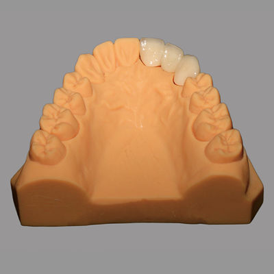 Buy ADL Dental Laboratories Inc | Biocompatible Full Ceramic PFZ Bridge With CAD / CAM System online manufacture