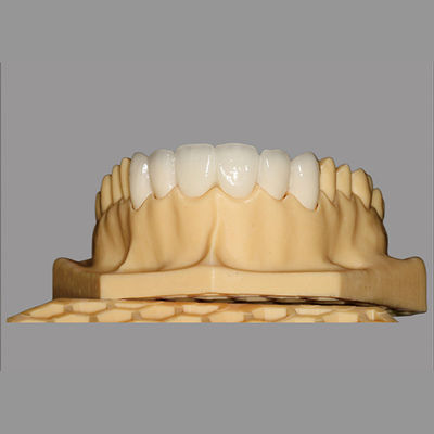 comprar China subcontrata laboratorio dental | Porcelana estética fundida al puente de circonio hipoalergénico. online manufacture