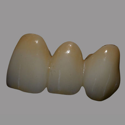 Buy Dental Lab Zirconia Price | Natural Full Contour Zirconia Bridge Single Unit / Multiunit Wear Resistant online manufacture