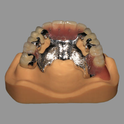 Beli CoCr Acrylic Cast Metal sebagian dikombinasikan dengan PFM tetap online manufacture