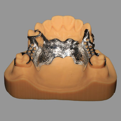 Buy 3D Printed CoCr Metal Framework Partial Nickel Free Lightweight online manufacture