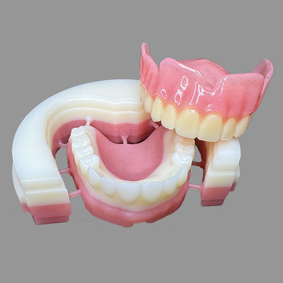 kopen CAD/CAM Digitaal geslepen acrylbasisprothese verwijderbaar online manufacture