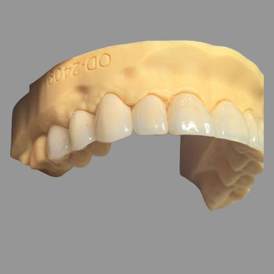 comprar Laboratório de coroa Emax | Alise as coroas pressionadas de IPS EMax que mancham customizável resistente online manufacture