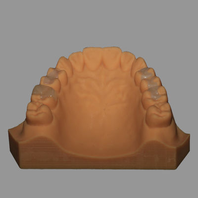 buy Emax  Dental Lab | Full Ceramic Dental Emax Inlay Onlay Crown Pressed / Milled online manufacture