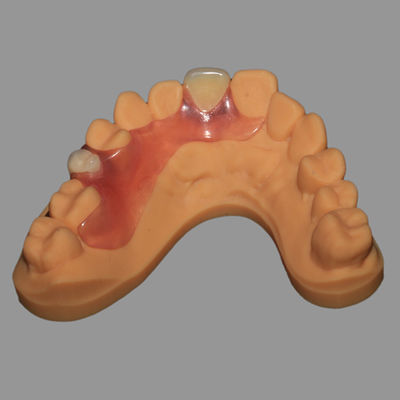 Buy Natural Looking Valplast Flexible Partial Adjustable Fracture Resistant online manufacture