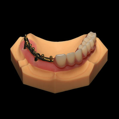 kopen Klasse 3 Gefreesde Titanium Bar All On X Tandheelkundige Implantaten met Volledige Acrylaat Prothese online manufacture