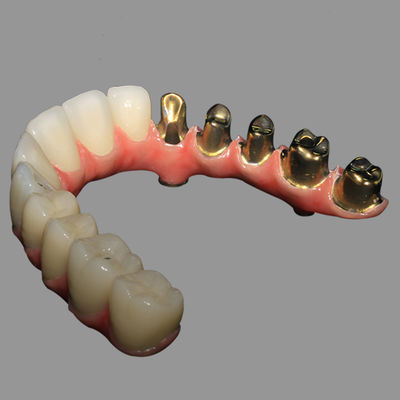 kopen Tandheelkundig implantaatlaboratorium | Klasse 2 hybride Malong volledige boog AOX implantaatbrug titanium staaf met volledig massief zirkonia online manufacture