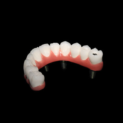 Buy AOX Class I All On 4 Dental Implants Hybrid Titanium Screw Retained PFM online manufacture