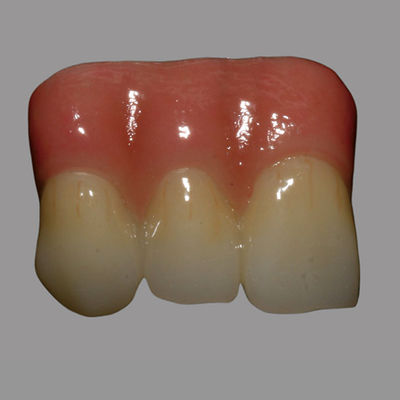 acheter CAD / CAM pont dentaire en zirconium en couches avec porcelaine rose online manufacture