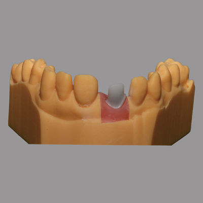 주문 흰색 맞춤 Zirconia Abutment 천연 치아 복원을 찾고 online manufacture
