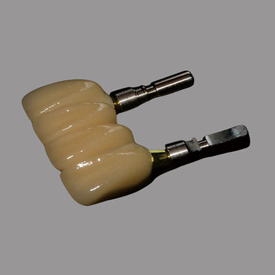 kopen Tandheelkundige outsourcing in China | Vergulde stikstof-titanium abutments Tandimplantaten Cad/Cam-compatibiliteit online manufacture