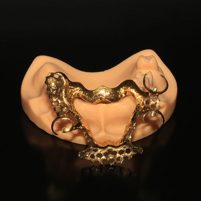 kopen Tandheelkundige outsourcing in China | Geanodiseerd 3D-geprint titaniumframe Lichtgewicht voor gevoelige huid online manufacture