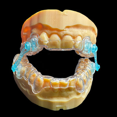 Buy Dental Lab Outsourcing | Anti Snoring Device Dental Occlusal Splint Clear Color Non Invasive online manufacture