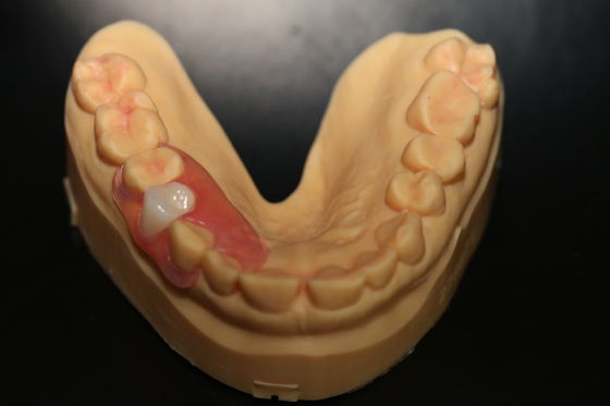 buy Flexible Partial Denture Lab | Natural Look TCS Flexible Denture Stain Resistant BPA Free online manufacture