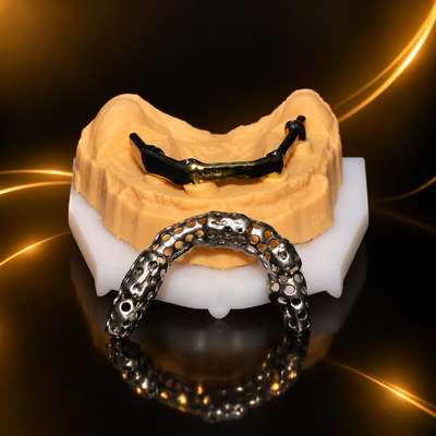 buy Gigital Dental Laboratory | Class 5 All On 4 AOX Implants With Hybrid Titanium Bar / Clips / Metal Mesh / Full Denture online manufacture